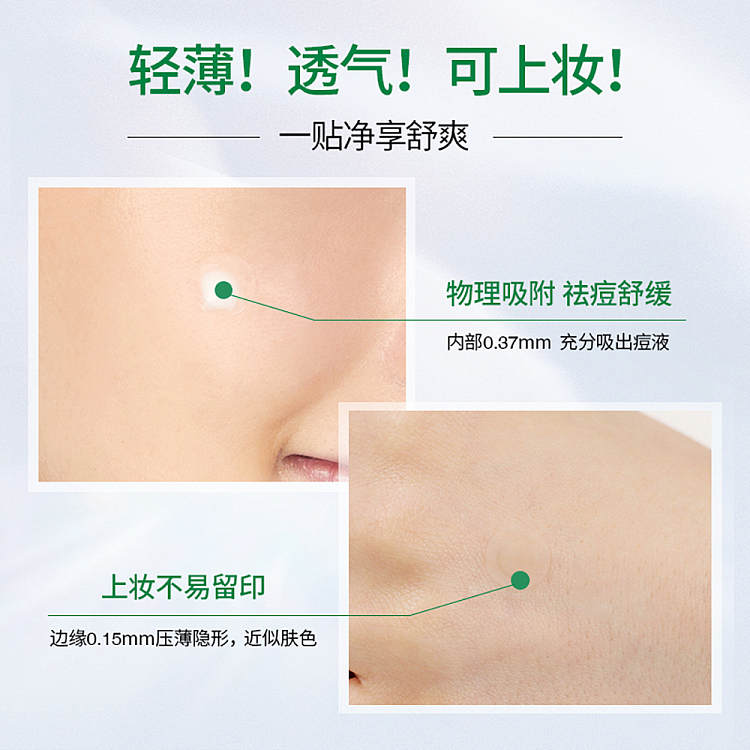 vita-green-tiger-acne-patch-4