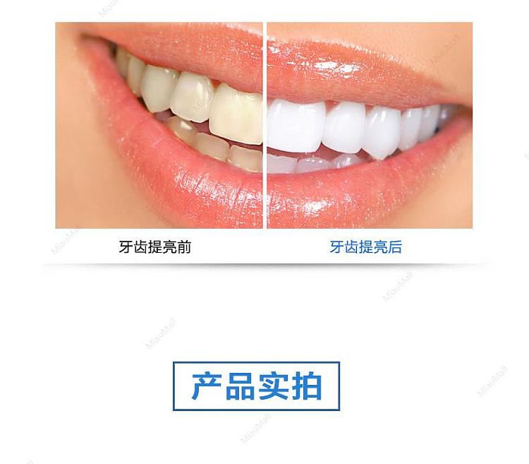smile-cosmetique-teeth-white-pack-8