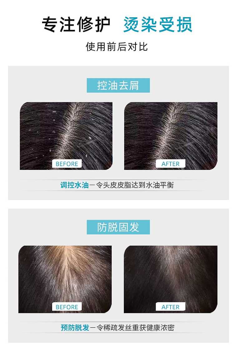 lion-king-double-repair-shampoo-anti-dandruff-and-anti-itch-200ml-7