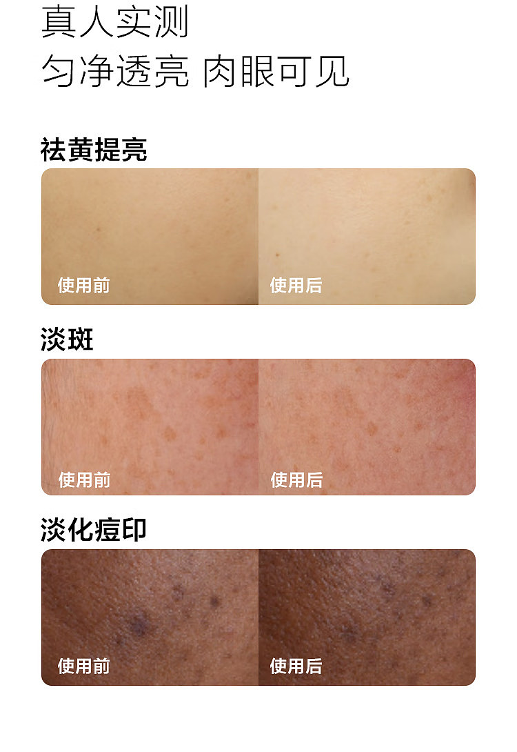 clinique-new-302-photon-laser-bottle-whitening-spot-correction-essence-30ml-12