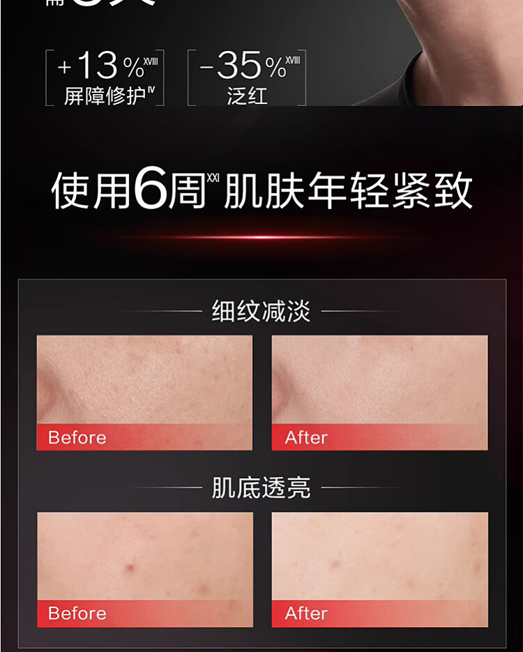 shiseido-redness-skin-activation-3rd-generation-red-cashew-essence-50ml-12