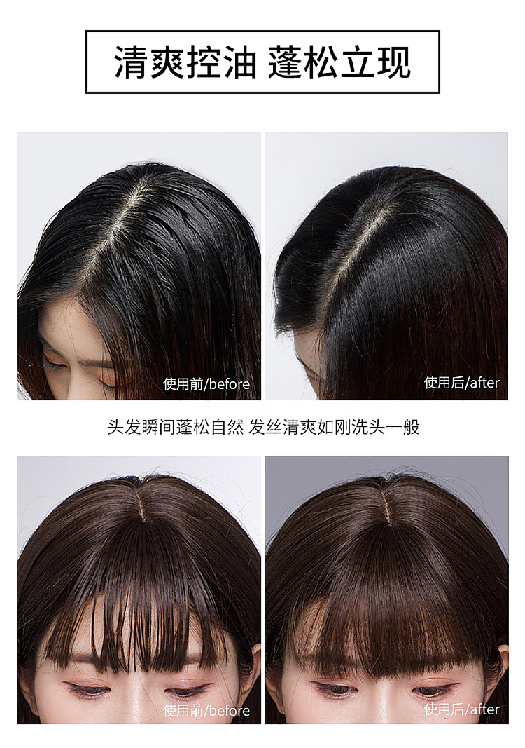 shiseido-dry-shampoo-spray-150ml-5