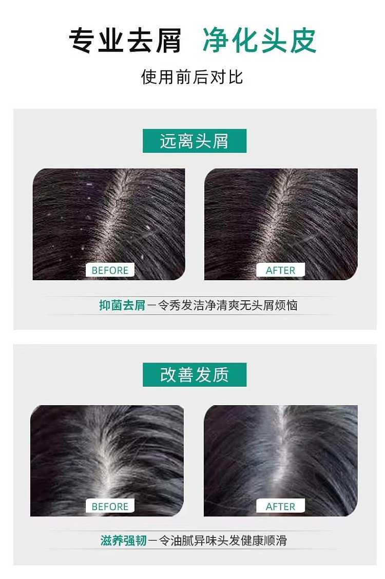 lion-king-anti-dandruff-anti-medicinal-itch-shampoo-320ml-4