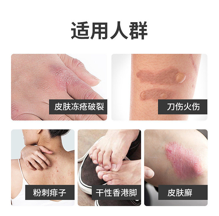 eronaing-h-ointment-30g-hong-kong-version-6