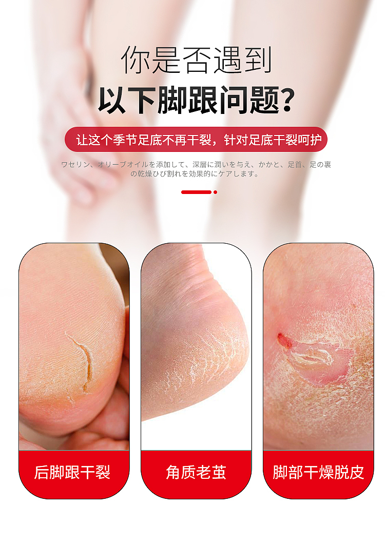 kobayashi-pharmaceutical-plantar-heel-anti-cracking-repair-foot-cream-30g-2
