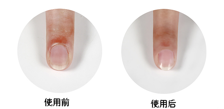 kobayashi-pharmaceutical-nail-polisher-4-pieces-6