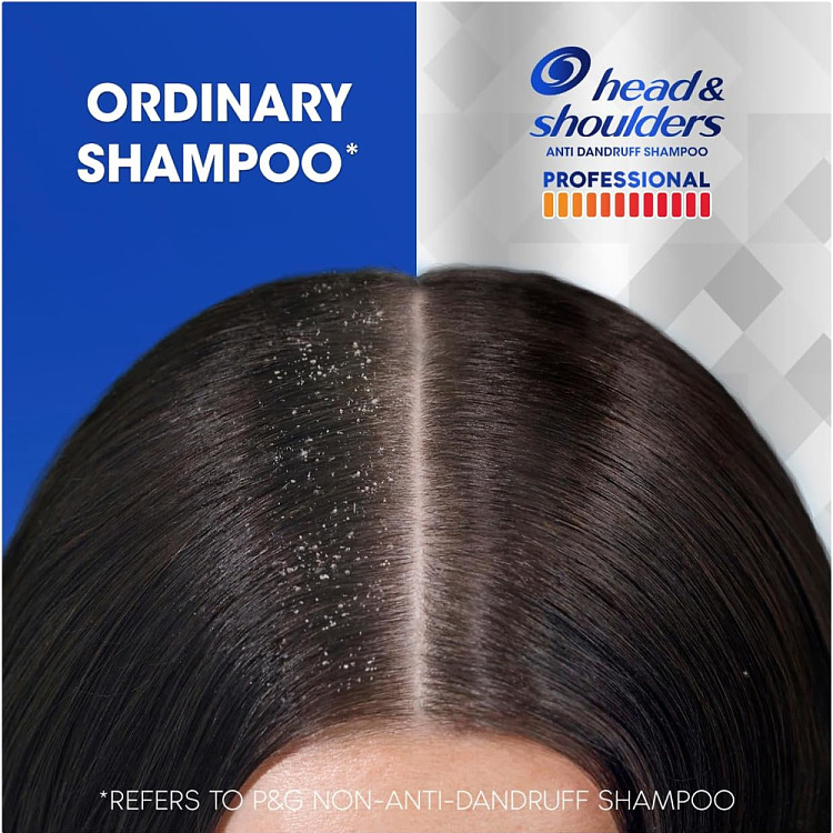 hafez-professional-strength-oil-control-anti-dandruff-shampoo-300ml-2