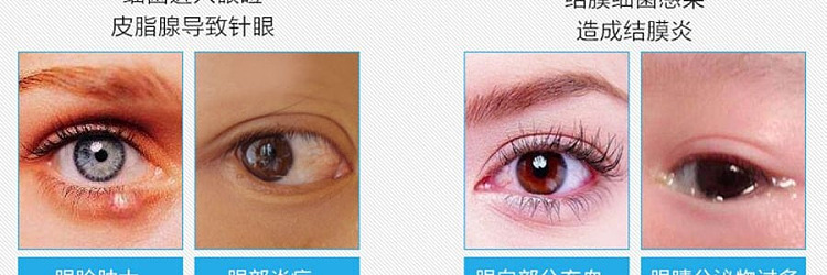 ledum-conjunctivitis-treatment-eye-drops-05ml20pcs-8