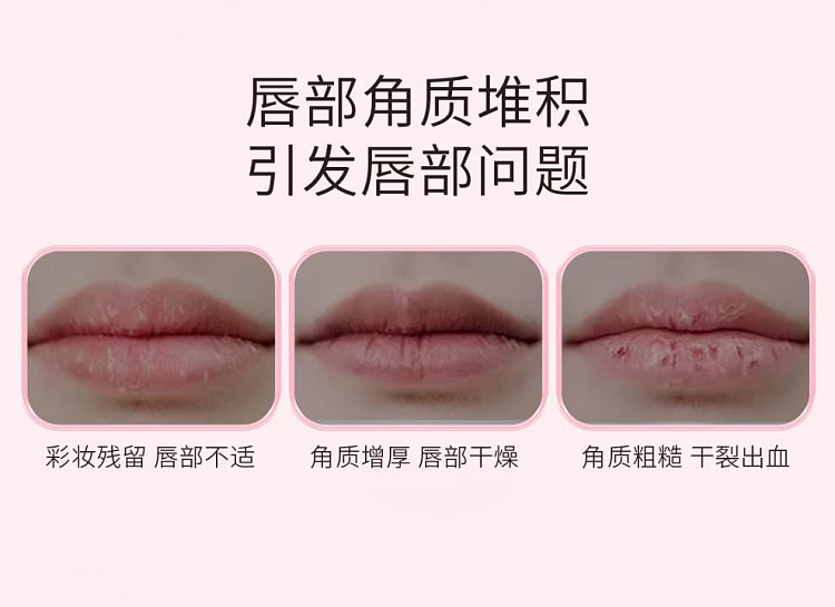 mentholatum-exfoliating-lip-balm-36g-2