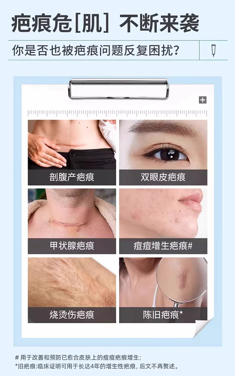 barker-scar-removal-cream-15g-hong-kong-version-1