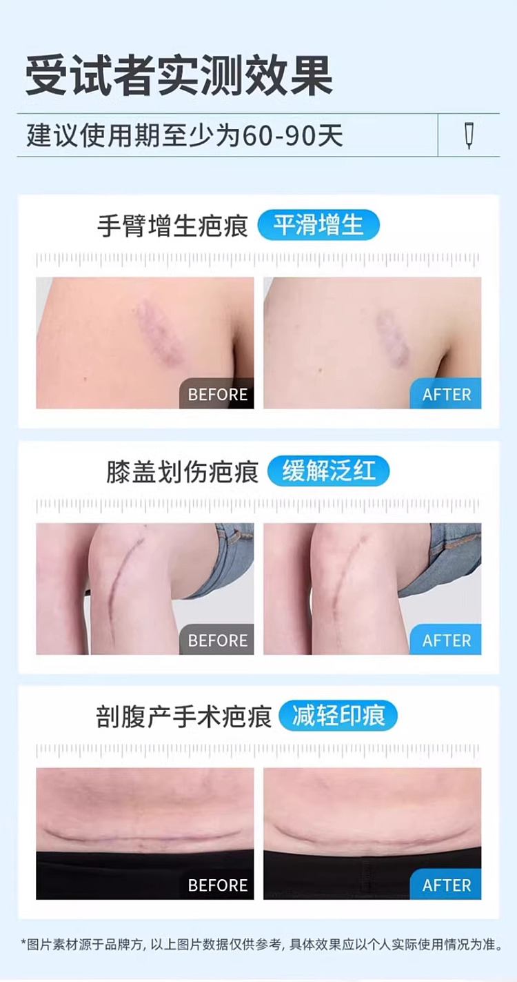 barker-scar-removal-cream-15g-hong-kong-version-8