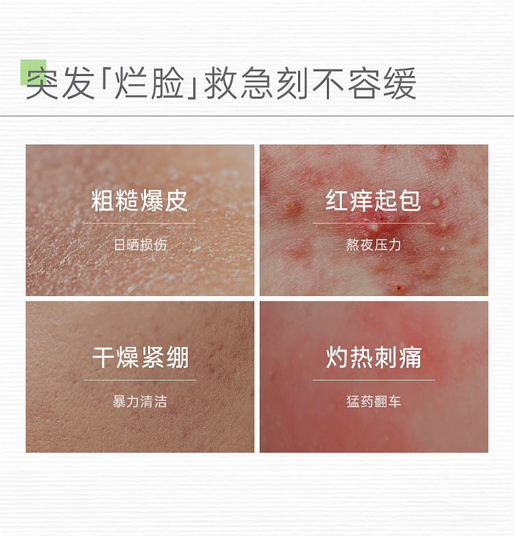 tamasawa-skin-barrier-repair-ceramide-conditioning-lotion-50ml-3