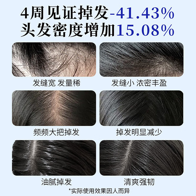 ehd-anti-hair-loss-and-hair-strengthening-shampoo-500ml-5