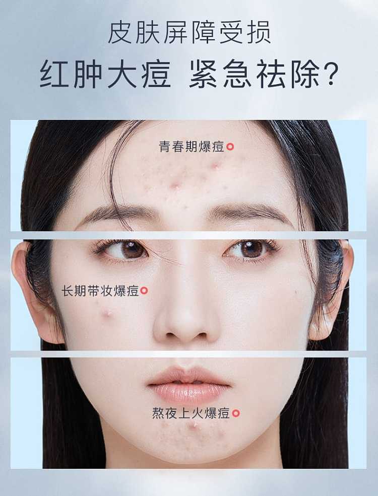 fuqing-medical-white-membrane-functional-dressing-facial-mask-5-piecesbox-3