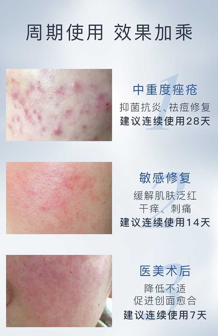 fuqing-medical-white-membrane-functional-dressing-facial-mask-5-piecesbox-8