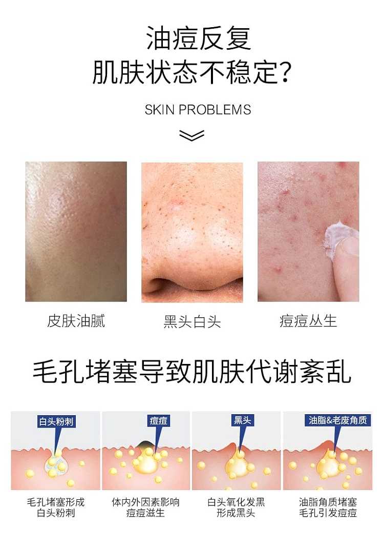 fucoidan-black-membrane-medical-healing-functional-mask-5pcsbox-2