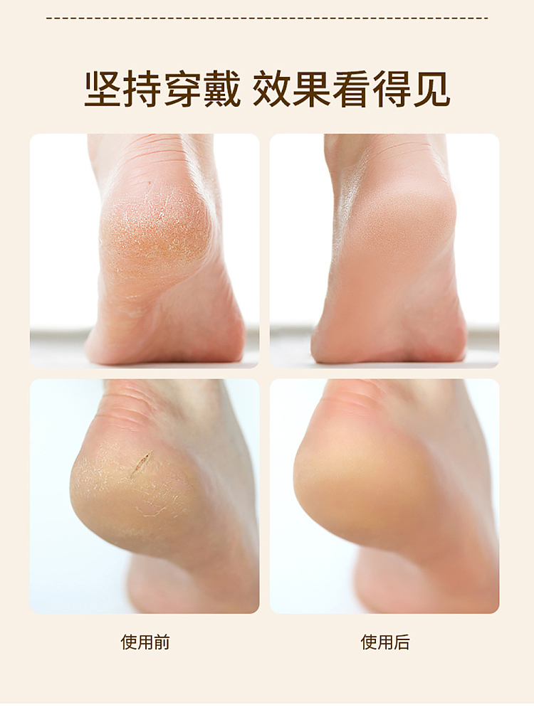 fasola-heel-crack-prevention-socks-skin-tone-one-pair-entry-5