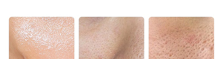 netflix-amino-acid-cleansing-mousse-150ml-58