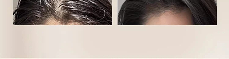 ruyi-anti-hair-loss-and-root-strengthening-shampoo-500ml-12