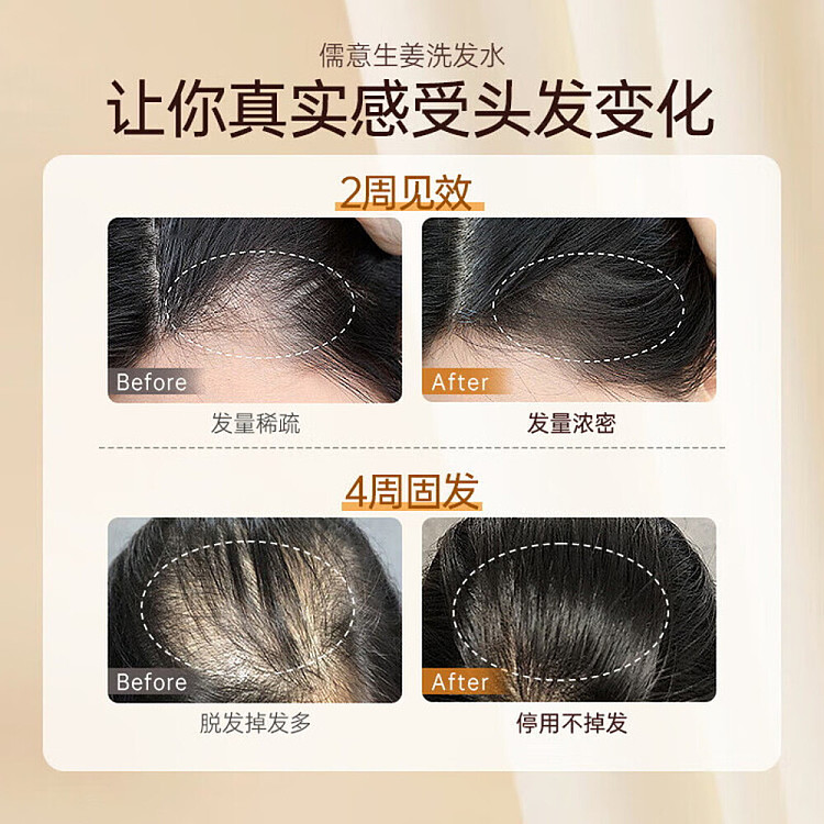 ruyi-anti-hair-loss-and-root-strengthening-shampoo-500ml-3