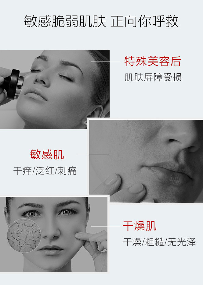 winona-soothing-and-sensitive-series-mask-2