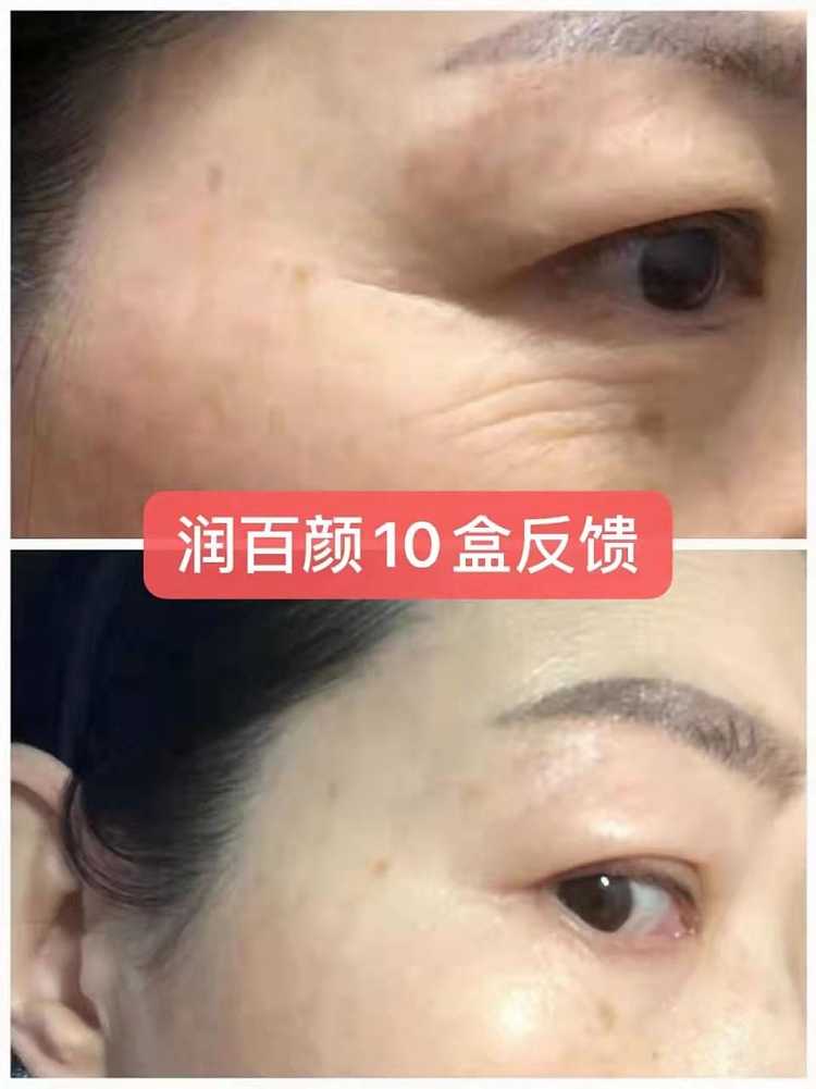 rb-ha-instant-anti-aging-sublimation-serum-3015ml-box-3