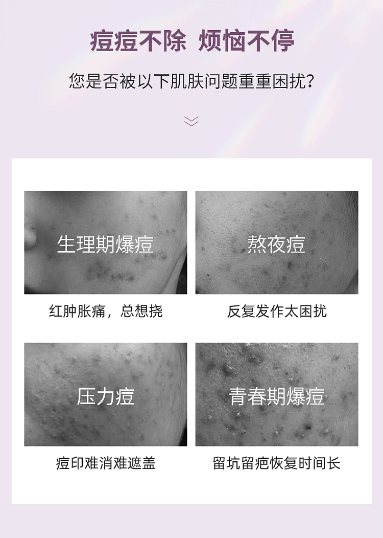 shikarjah-makeup-clear-acne-clear-skin-repair-patch-26g5-pieces-130g-2