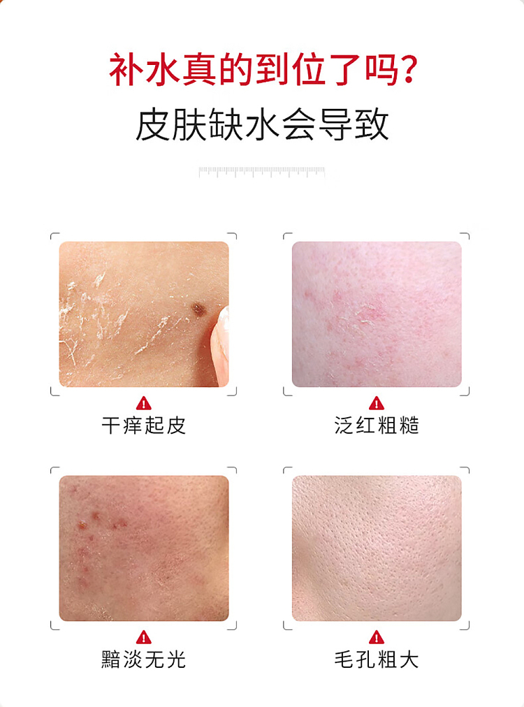 fuerjia-white-pond-lily-seed-lotion-mask-5pcs-2