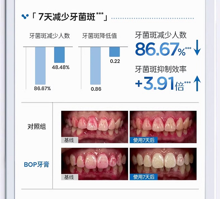 bop-active-antibacterial-peptide-toothpaste-stain-removal-whitening-120g-15