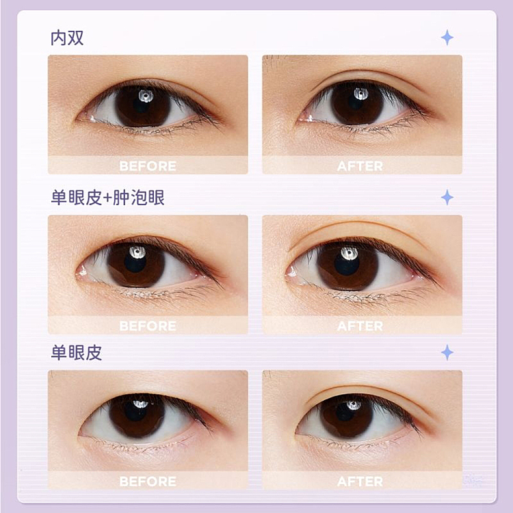 everbab-natural-double-eyelid-stick-m-400pcs-5