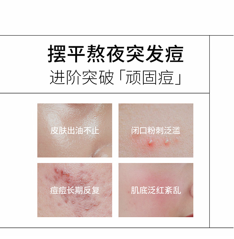 beauty-beauty-oil-control-acne-treatment-serum-15ml30-3