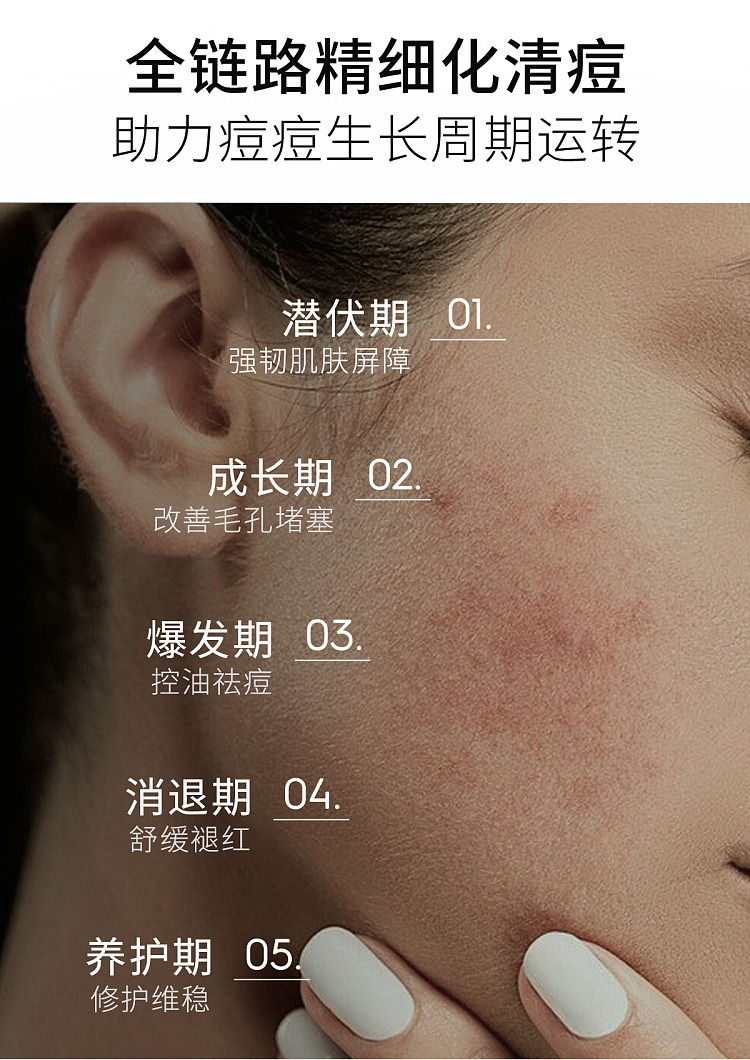 beauty-beauty-oil-control-acne-treatment-serum-15ml30-4