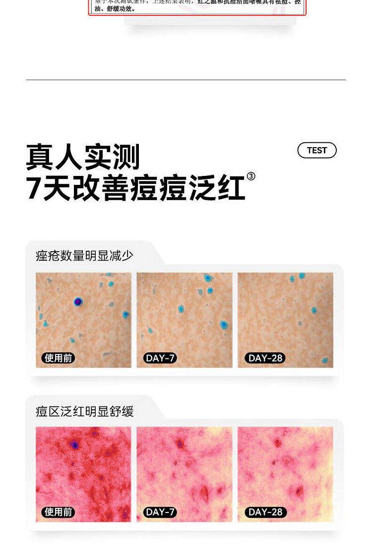 red-gentle-acne-fighting-cleansing-gel-for-acne-prone-skin-100g-5
