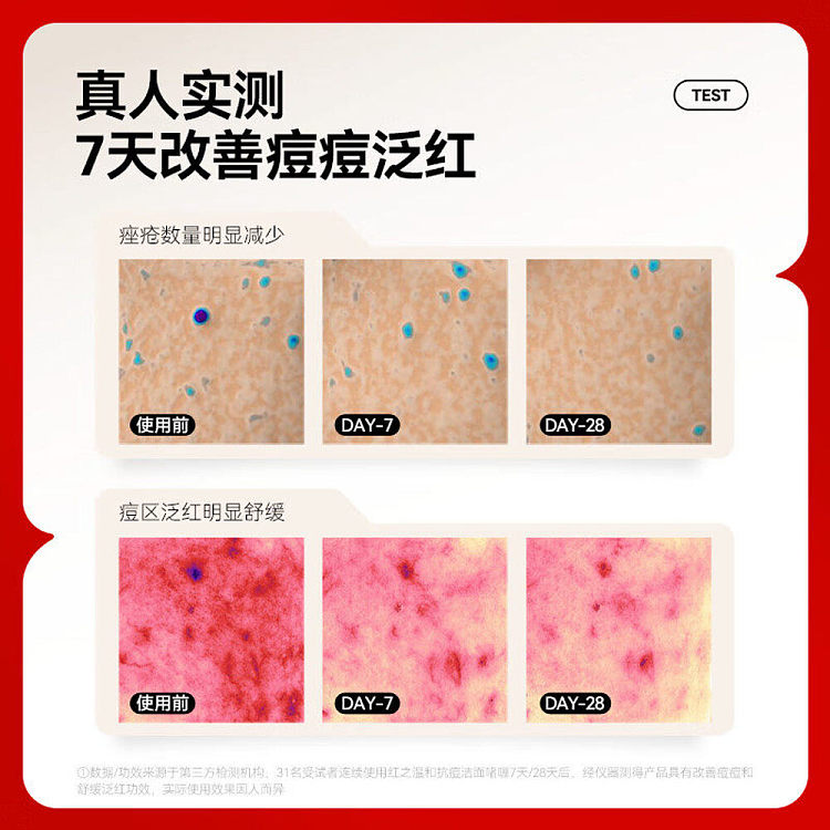 red-gentle-acne-fighting-cleansing-gel-for-acne-prone-skin-100g-4