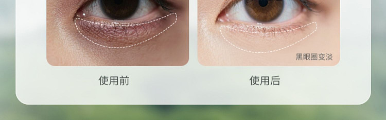 ruyi-firming-eye-mask-60pcs-15
