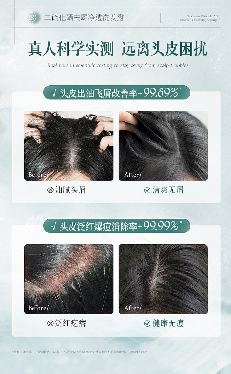 ruyi-selenium-disulfide-anti-dandruff-shampoo-500ml-10