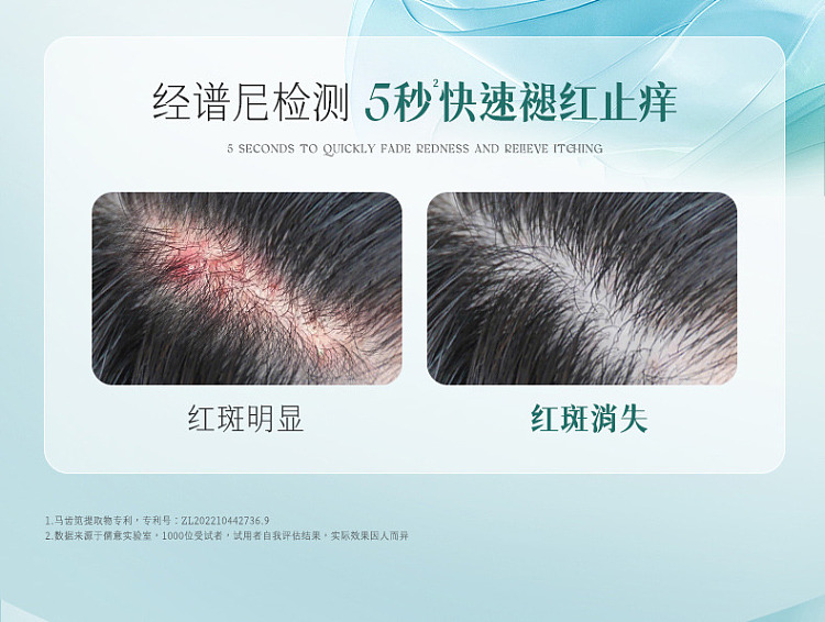 ruyi-selenium-disulfide-anti-dandruff-shampoo-500ml-17