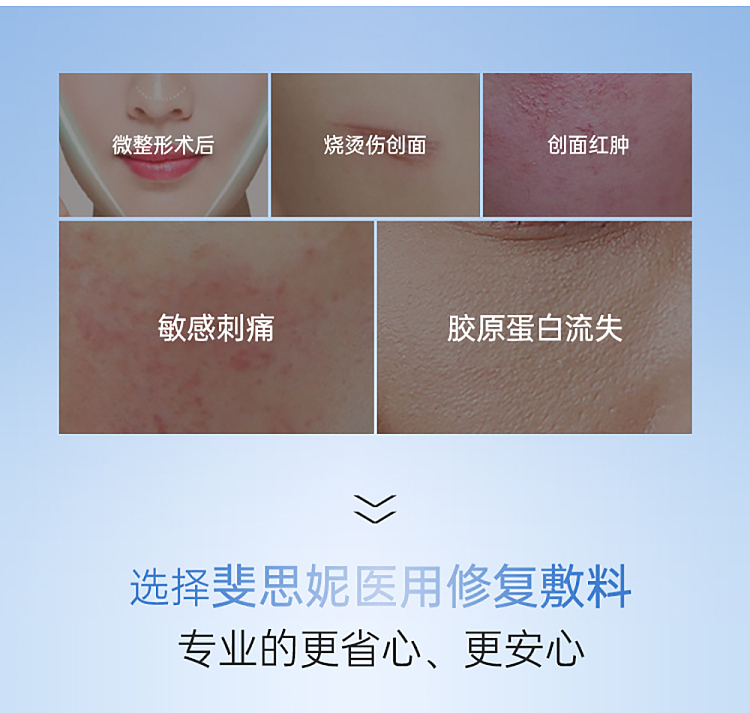 fesini-recombinant-humanized-collagen-dressing-mechanical-25ml5-tablets-box-2