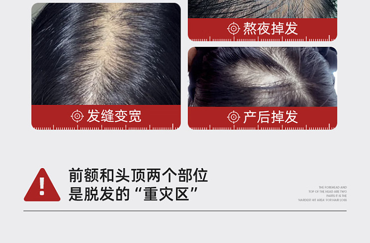 three-magic-hairdressers-anti-hair-loss-essence-shampoo-400ml-7