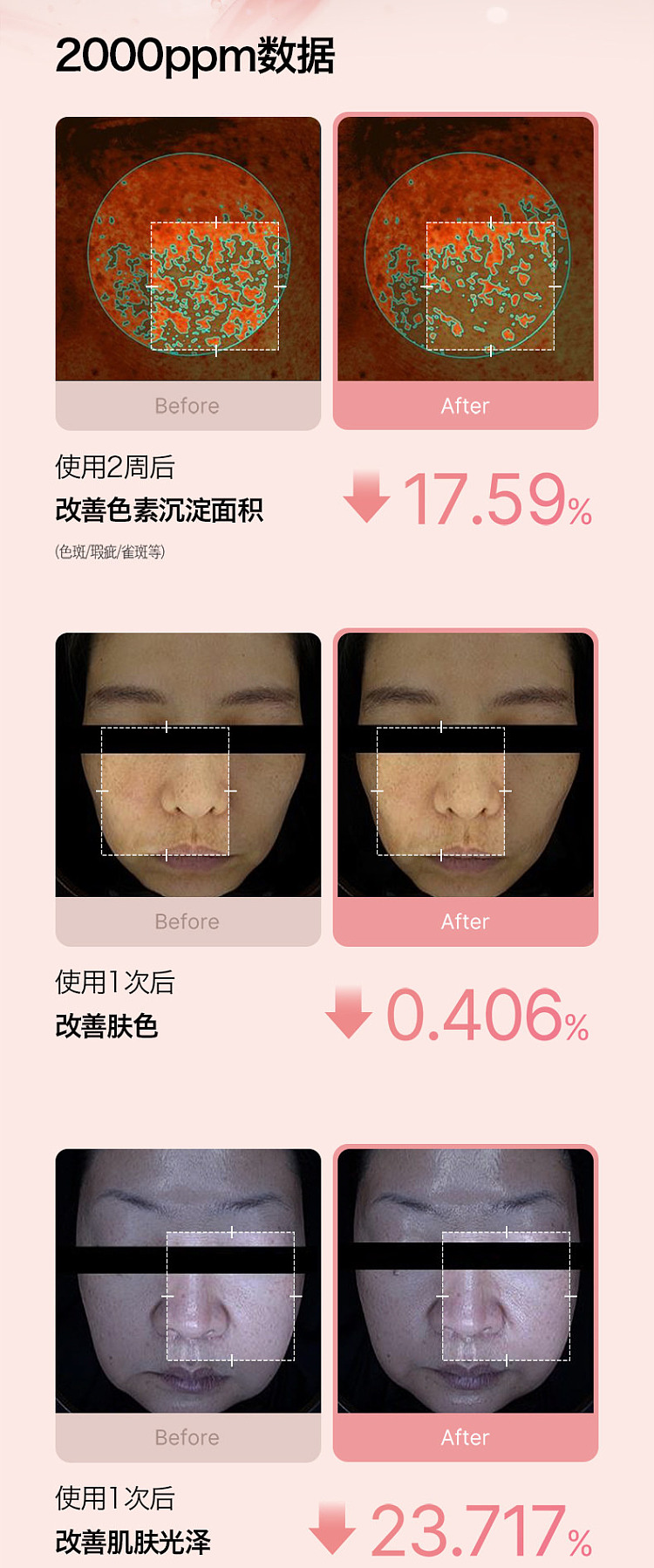 medicube-pdrn-collagen-exosome-microneedle-serum-7500-pink-30ml-south-korea-8