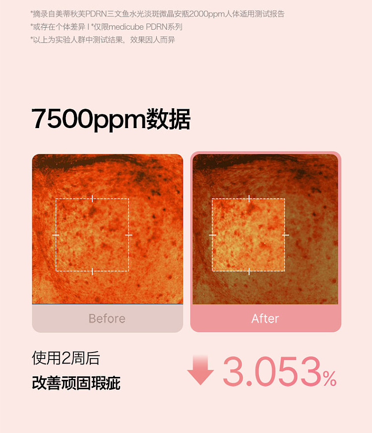 medicube-pdrn-collagen-exosome-microneedle-serum-7500-pink-30ml-south-korea-9