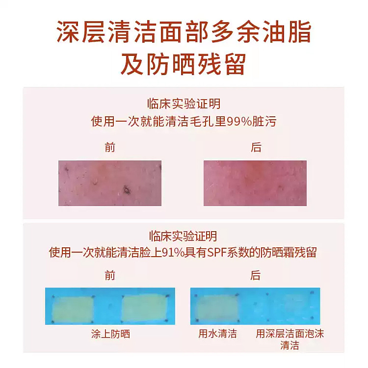 skin1004-pore-purifying-firming-deep-cleansing-foam-125-ml-3