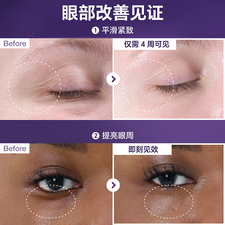 numbuzin-9-nad-retinol-volumetox-eye-cream-10ml-4