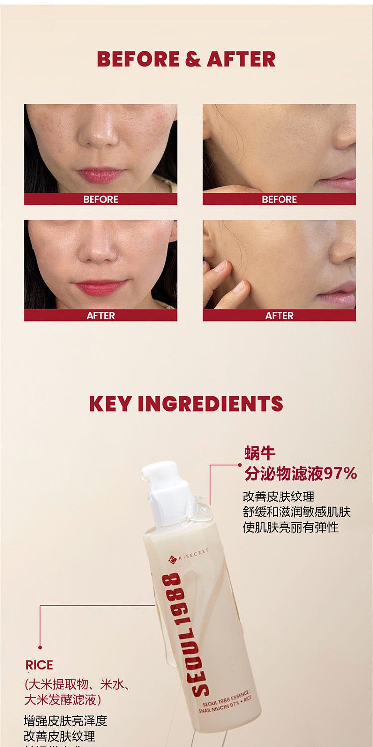 ksecret-seoul-1988-snail-mucin-97-rice-serum-100ml-3