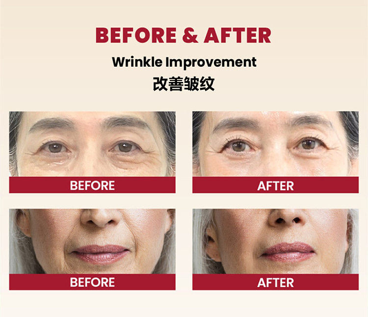 ksecret-seoul-1988-retinoid-liposome-1-fermented-rice-cream-100ml-3