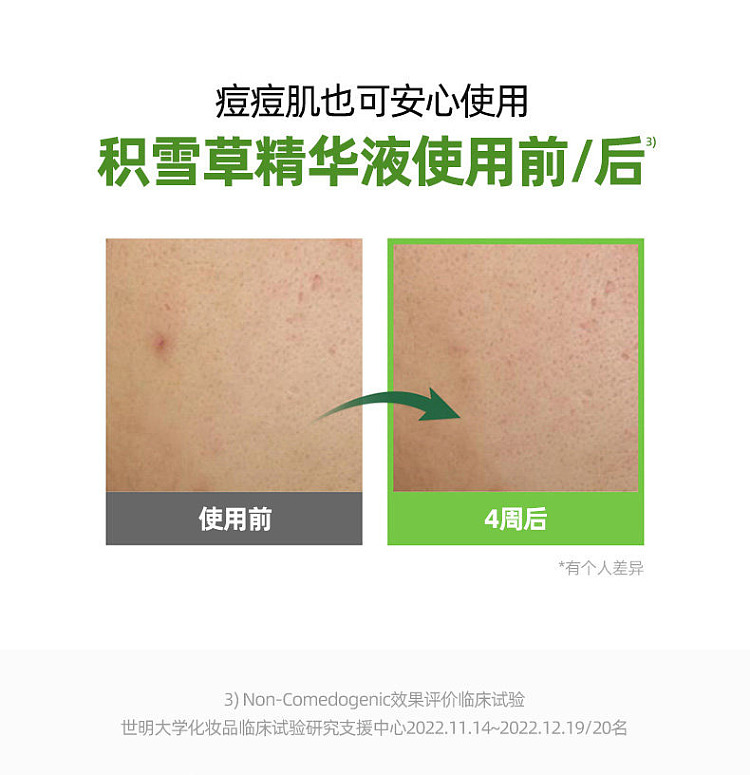 torriden-centella-asiatica-moisturizing-soothing-essence-50ml-20
