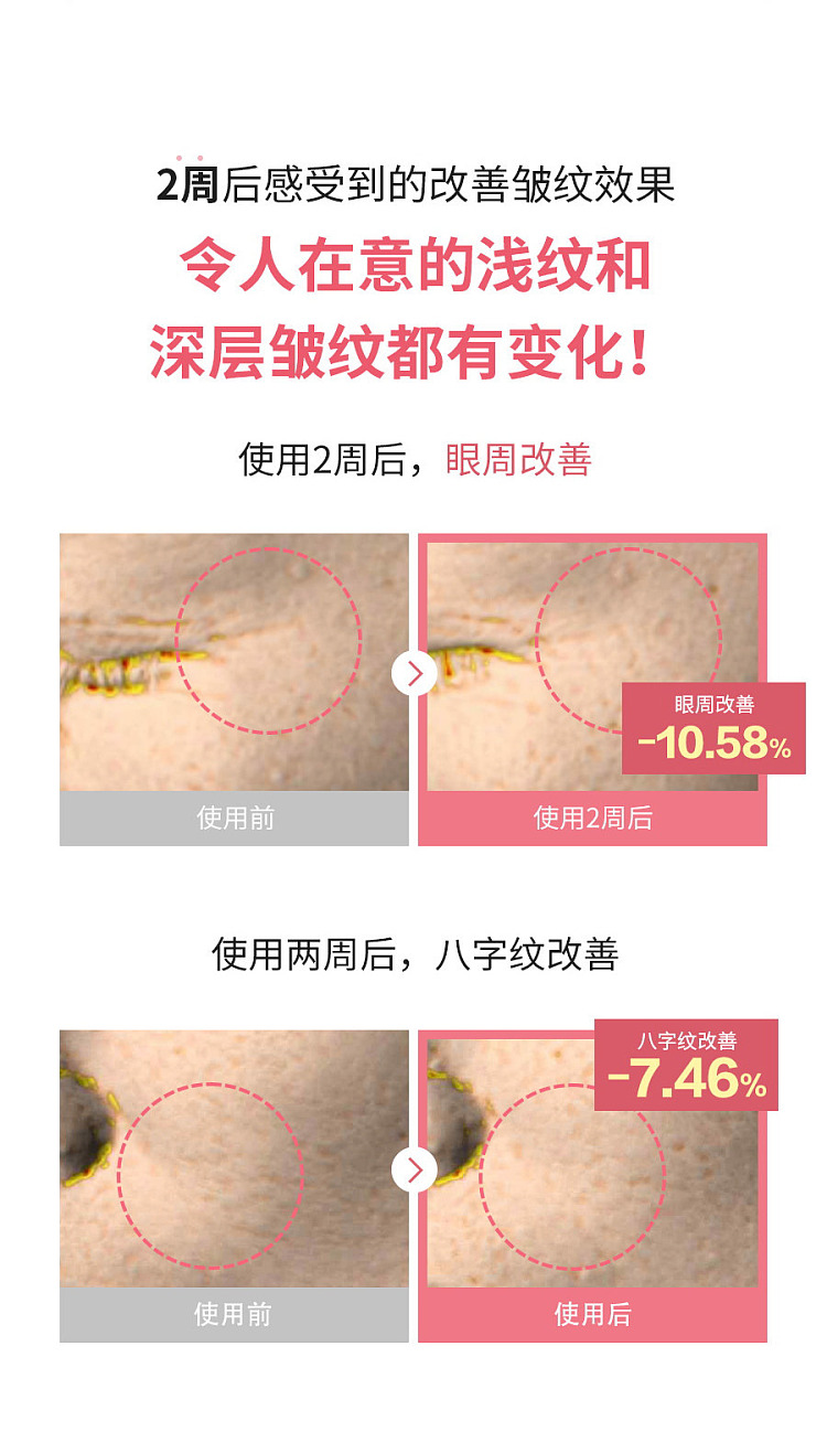 torriden-collagen-elastic-eye-cream-30ml-14