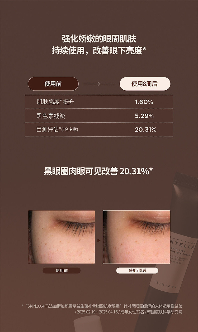 skin1004-madagascar-brown-probiotic-eye-cream-20ml-12