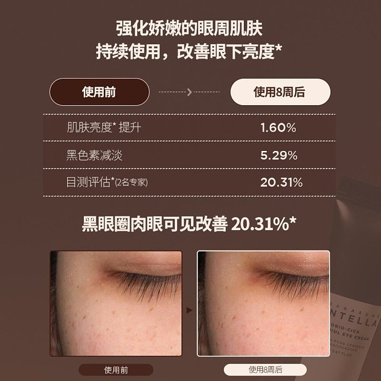 skin1004-madagascar-brown-probiotic-eye-cream-20ml-3
